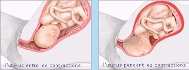 l'utrus entre et pendant les contractions